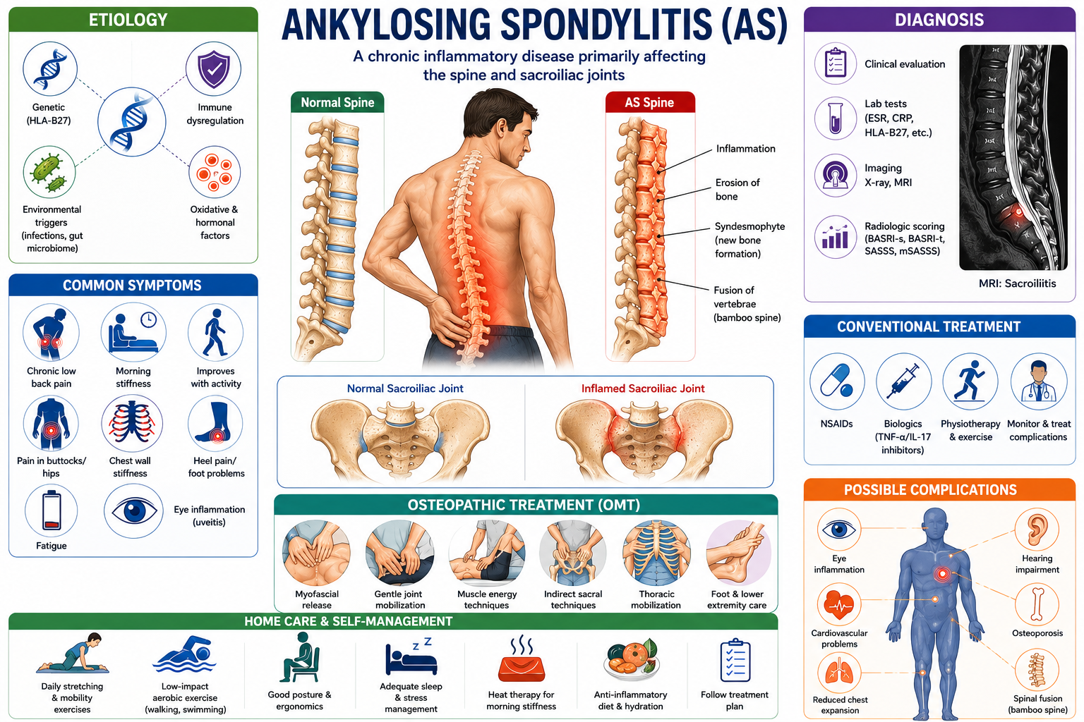 Ankylosing spondylitis is a chronic inflammatory condition that primarily affects the spine and sacroiliac joints, causing persistent stiffness, back pain, and reduced mobility. Early diagnosis helps slow structural damage, while treatment focuses on reducing inflammation, preserving spinal function, and improving quality of life. A combination of medical management, targeted exercise, and osteopathic techniques can help manage symptoms and enhance daily function. Understanding the condition empowers patients to take an active role in long-term care and self-management.